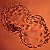 Un couple californien porte plainte après un échange d'embryons in vitro
