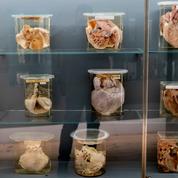 Entre pédagogie sans filtre et voyeurisme morbide, une collection d'anatomie humaine viennoise interroge