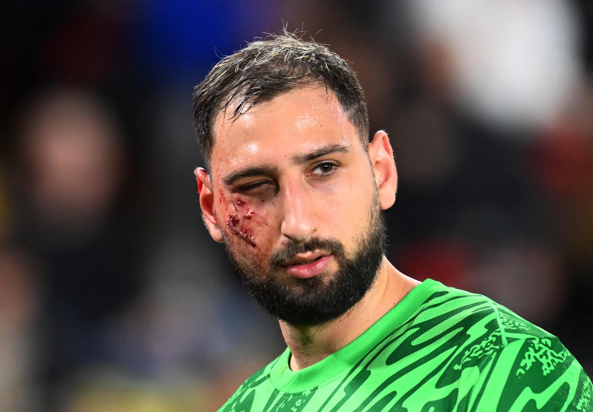 PSG : «Traumatisme facial avec de multiples plaies» pour Donnarumma