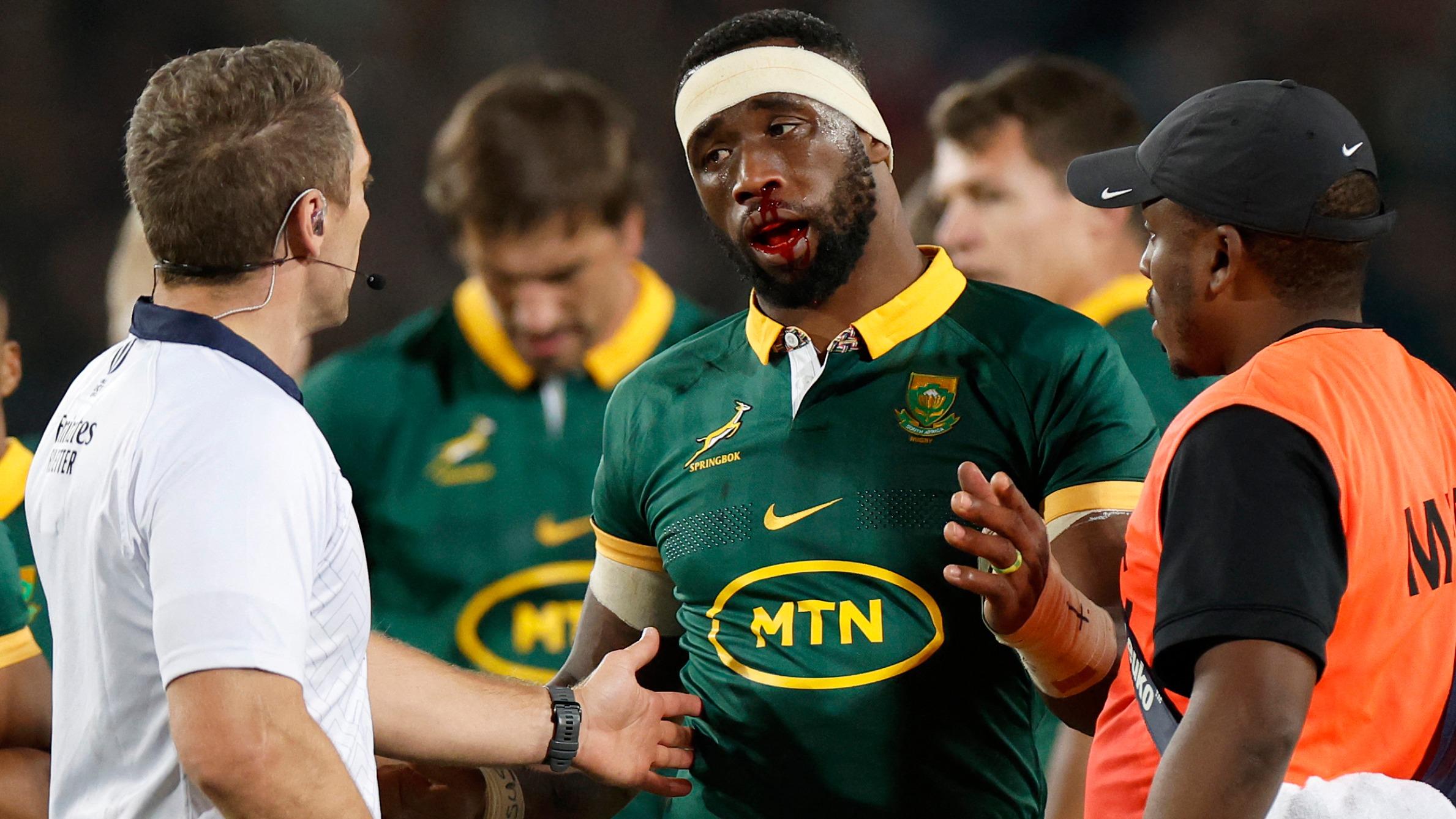 Rugby : craintes de fracture du visage pour le capitaine sud-africain Siya Kolisi