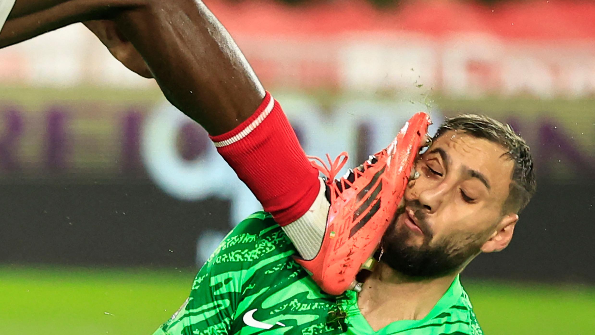 Monaco-PSG : en vidéo, le visage ensanglanté de Donnarumma après une action dangereuse de Singo