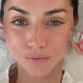 Lâactrice Ana de Armas, cliente de longue date du facialiste des stars IvĂĄn Pol, alias The Beauty Sandwich, en pleine session de «cupping».