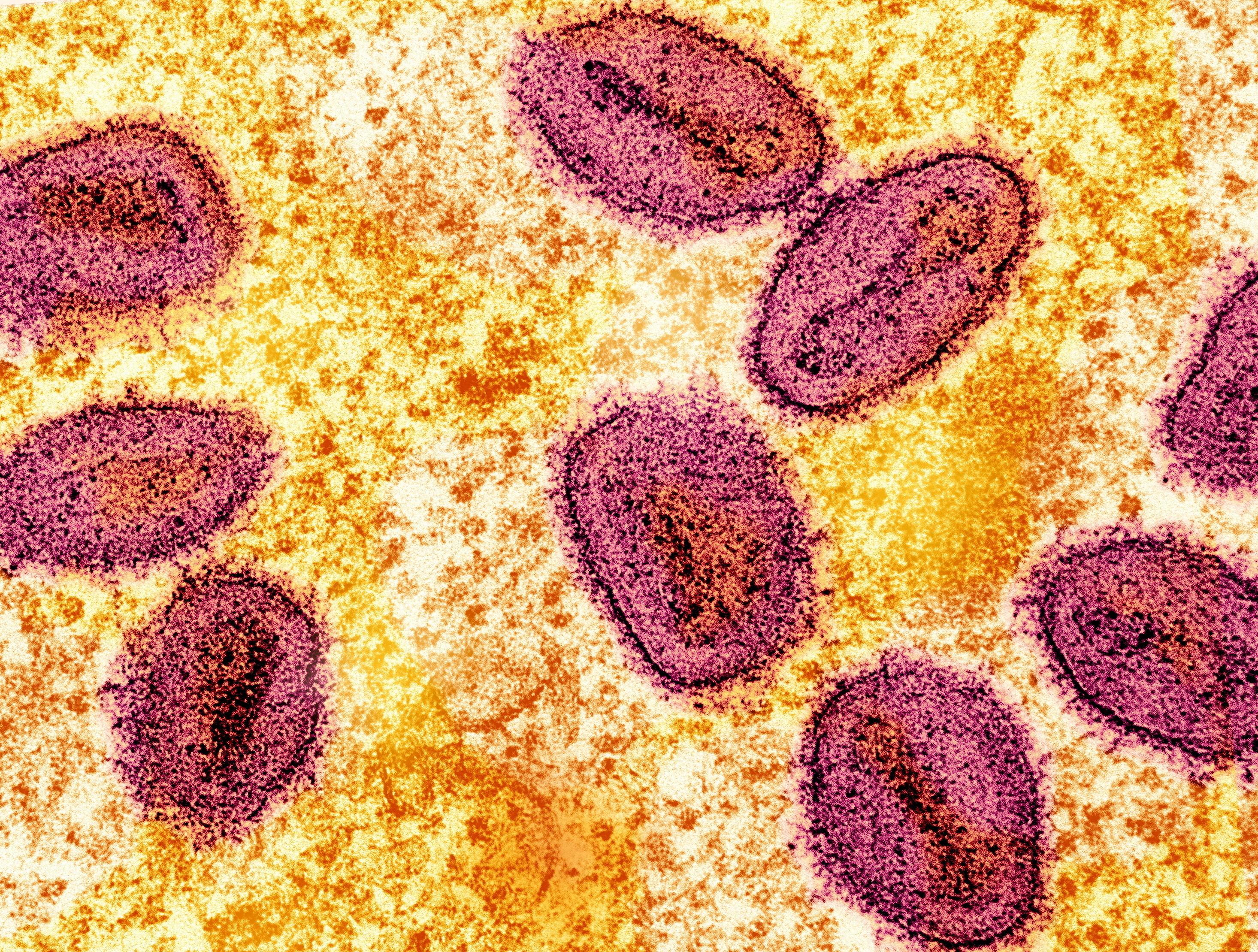 Mpox : l’Organisation mondiale de la santé maintient son plus haut niveau d’alerte