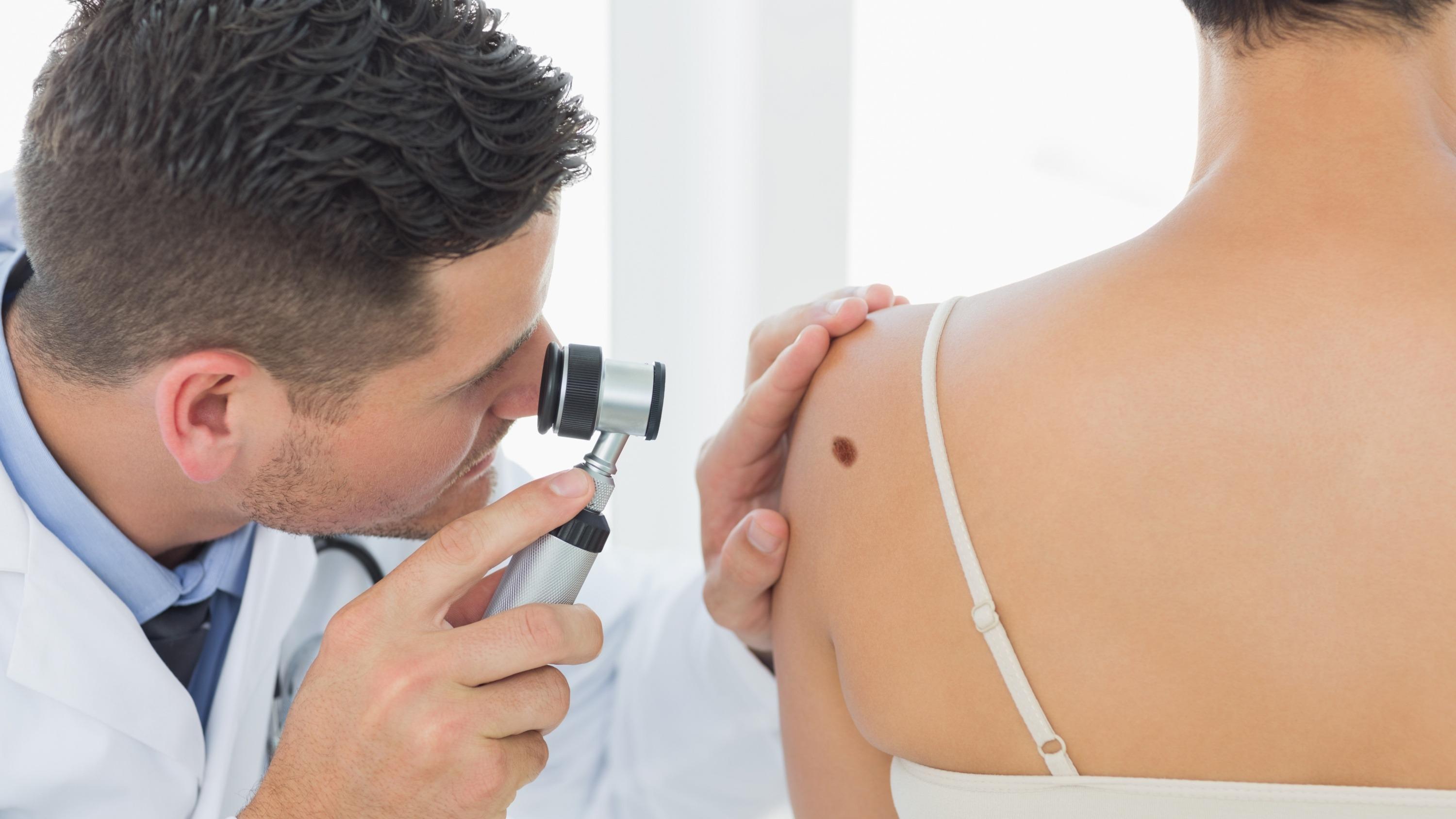 Premier succès prometteur d’un vaccin ARN contre le mélanome : à l’aube d’une révolution en cancérologie ?