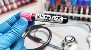 Mpox : faut-il s’inquiéter de la découverte du premier cas du nouveau variant en France ?