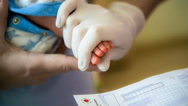 Dépistage néonatal : des centaines de maladies rares bientôt dépistées grâce à une méthode révolutionnaire