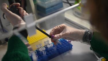 Le grand programme d’étude du microbiote de la population française a déjà reçu 30 000 échantillons