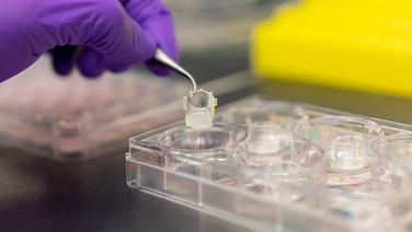 Dans les coulisses d’Episkin, le laboratoire de L’Oréal qui fabrique de la peau humaine