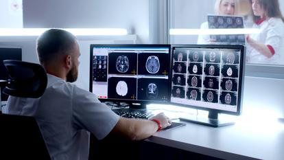 La maladie se caractérise par des dépôts de protéines anormales dans les neurones, ce qui entraîne des défauts de fonctionnement cérébral. Les symptômes dépendent des zones où se trouvent ces dépôts, ce qui explique leur variété d’un patient à l’autre.