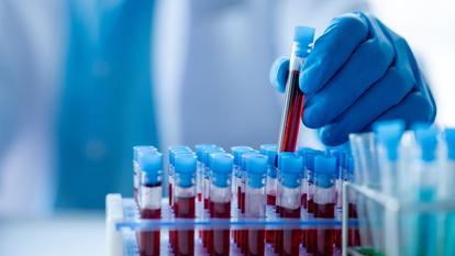 globules rouges, plaquettes, lymphocytes et autres cellules du système immunitaire...