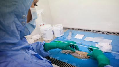 Préparation d’un échantillon de peau dans une biobanque de tissus et de cellules appartenant à l’EFS (Établissement français du sang).