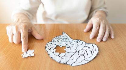 La maladie d’Alzheimer représente déjà un coût estimé à plus de 35 milliards d’euros par an, supporté par les familles, le système de protection sociale et la collectivité.