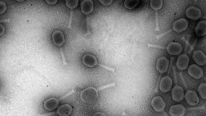 Observation au microscope électronique de phages thérapeutiques anti-Staphylococcus aureus (V1SA19) produits aux Hospices Civils de Lyon.