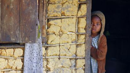 L’Afrique reste le continent le plus touché par l’excision, avec plus de 144 millions de filles et de femmes concernées.