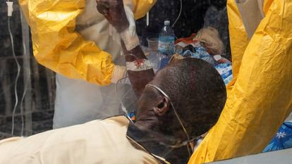 Un patient traité par Medecins Sans Frontieres (MSF).