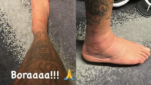 Coupe du monde : Neymar poste des photos inquiétantes de sa cheville