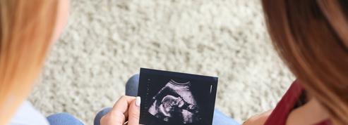 Dépistage prénatal : les autorités sanitaires veulent inclure un syndrome rare