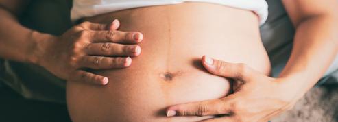 Tout savoir sur l'intrigante «ligne de grossesse» qui peut marquer le ventre des femmes enceintes