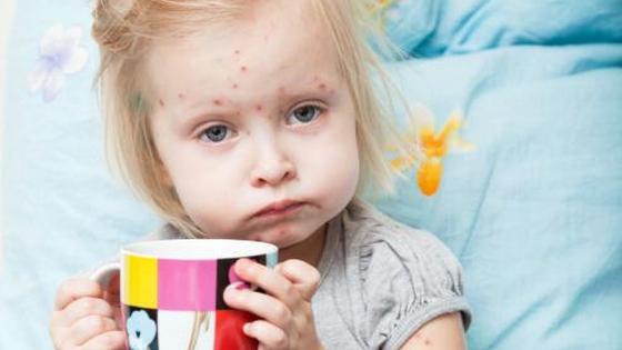 Rubéole : causes, symptômes et vaccination préventive