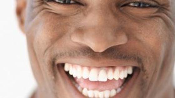 Endorphines : quels sont les bienfaits du rire sur la santé