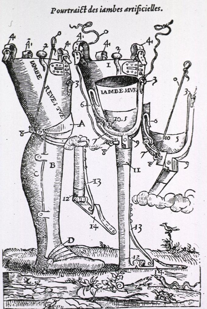 An artificial leg invented by Ambroise Paré.