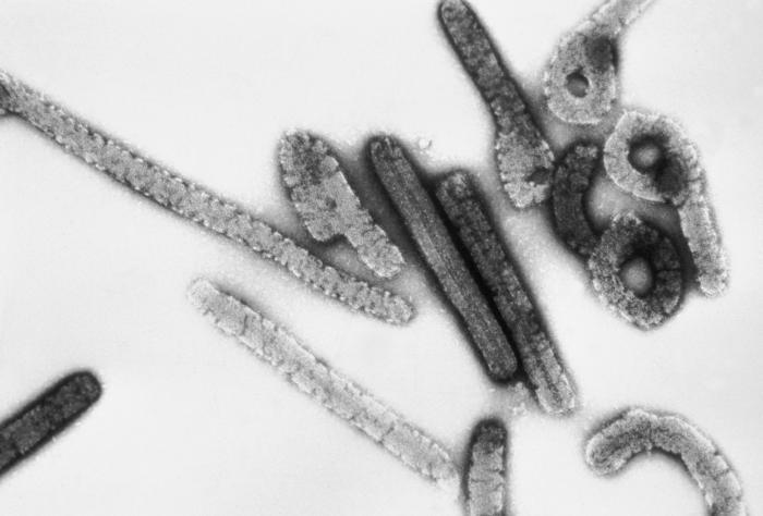 Particules du virus de Marburg visualisées à l'aide d'un microscope électronique à transmission 