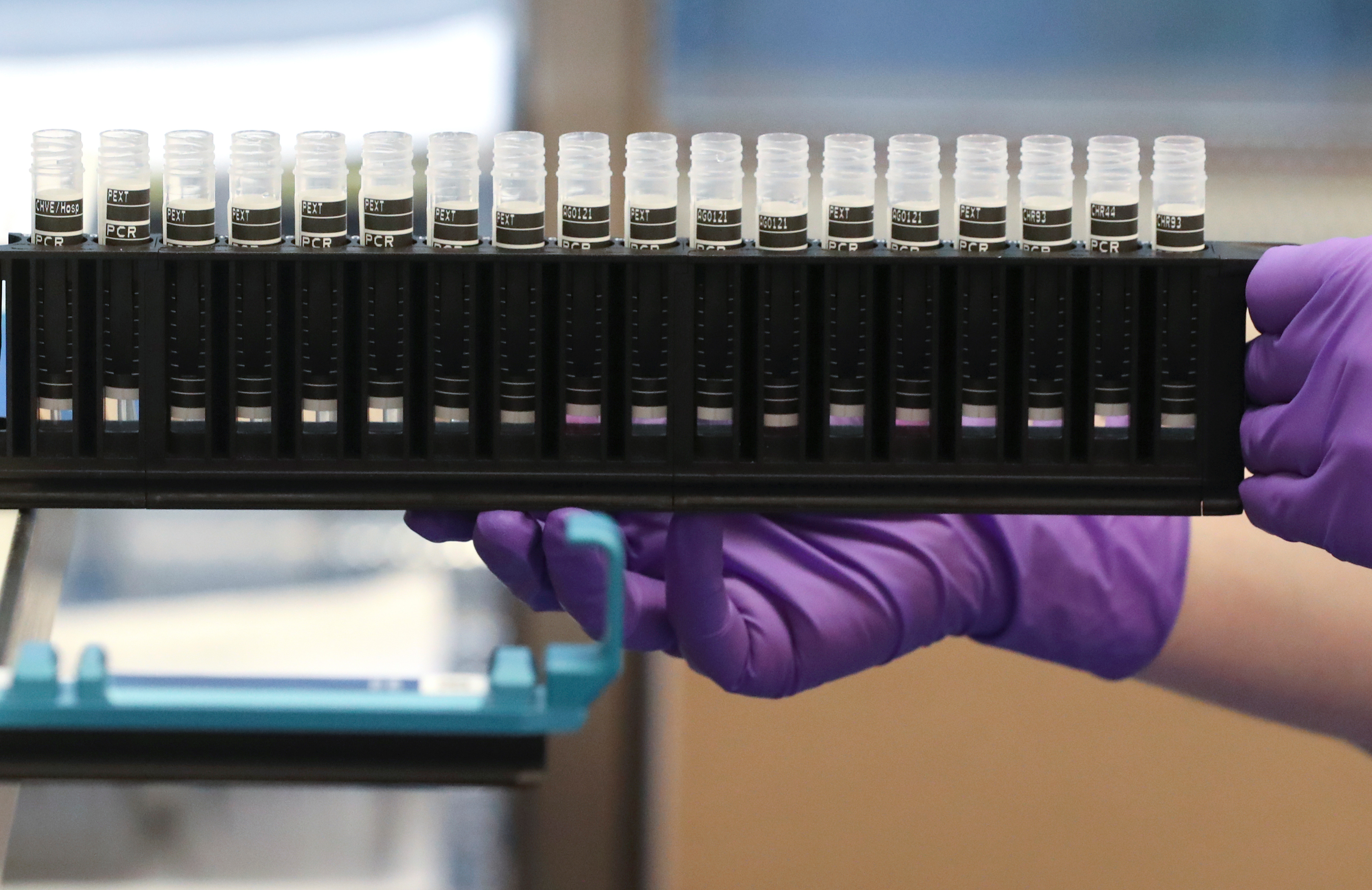 How Much Do Tb Tests Cost At Cvspittube - g7bqdhj