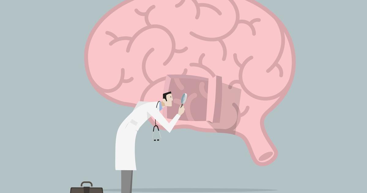 Que se passe-t-il dans le cerveau des malades d’Alzheimer
