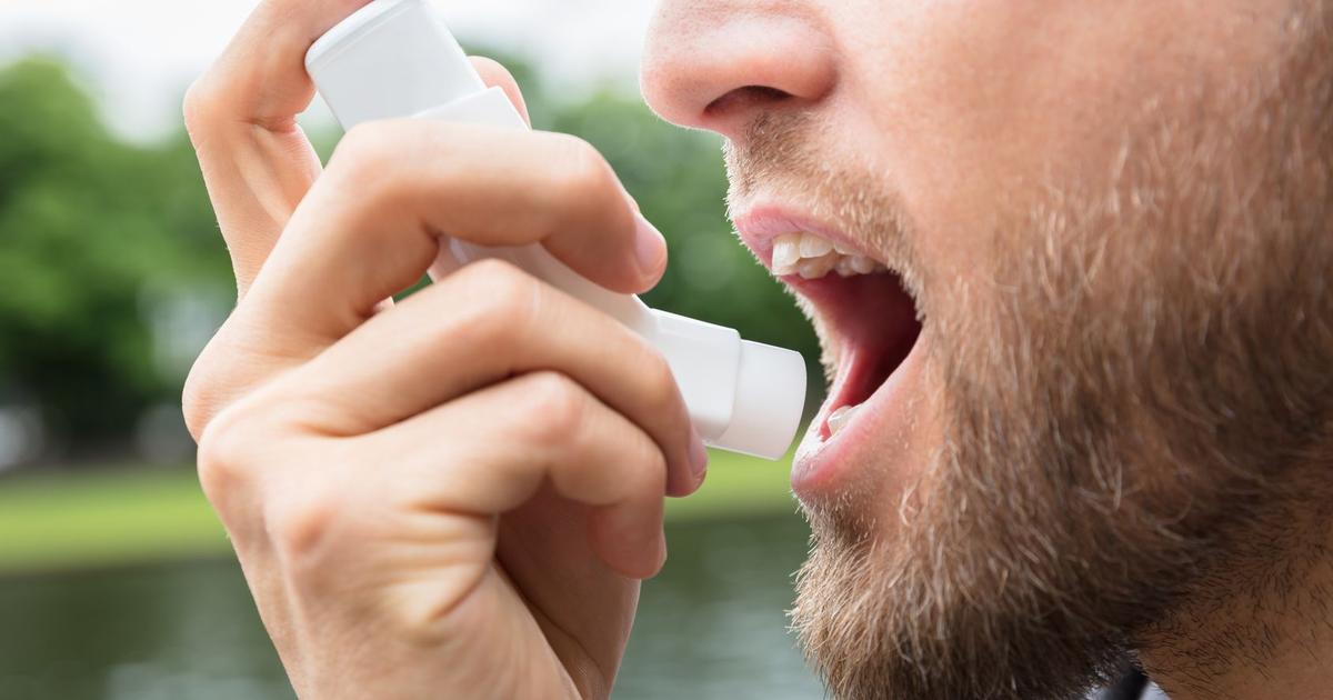 Asthme : le rôle protecteur de la testostérone