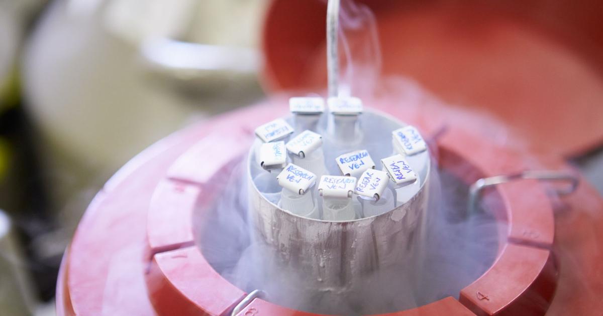 Âge limite, congélation des ovocytes le nouveau mode d’emploi de la PMA