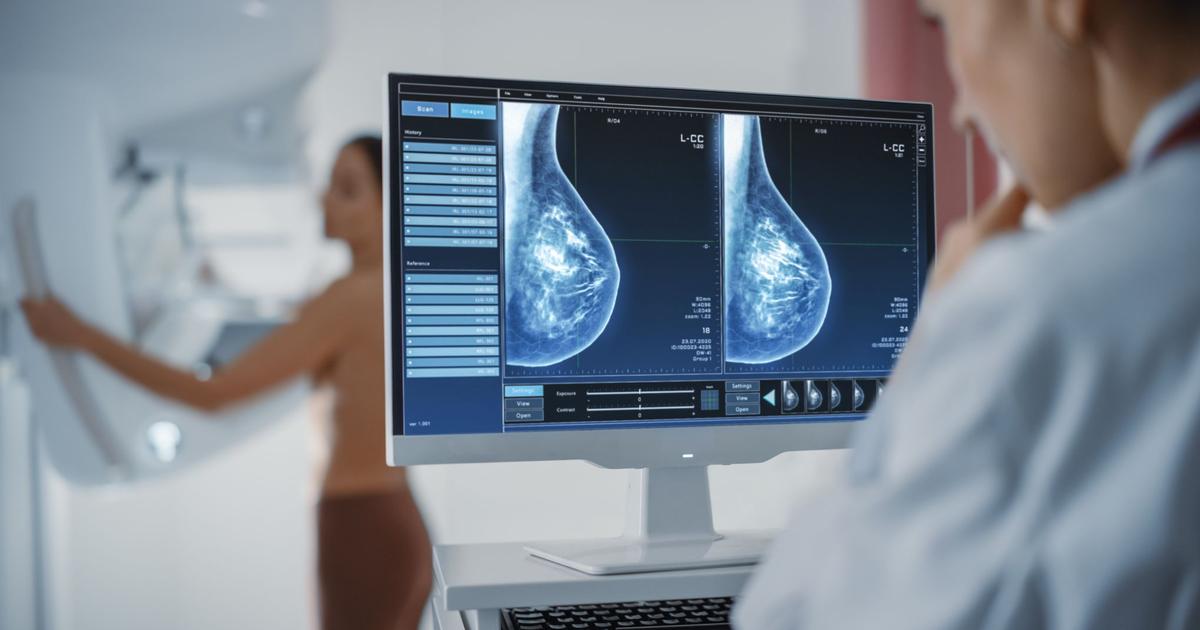 Cancer screening.  The rise of 3D mammography faces organizational issues