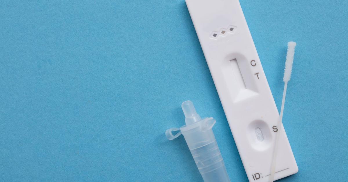 Covid-19: quel est le meilleur moment pour faire un test antigénique?