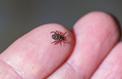 Maladie de Lyme: augmentation des cas en 2016