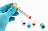  Le dépistage annuel de l’infection à chlamydia est recommandé