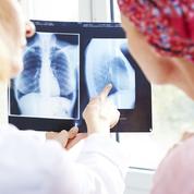 Un traitement prometteur contre des cancers avancés du poumon