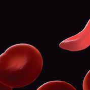 La thérapie génique à l’assaut d’anomalies de l’hémoglobine
