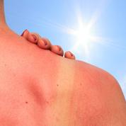 Psoriasis, dermatite atopique: ces maladies de peau qu’il faut exposer (un peu) aux UV