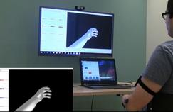 Amputés: la réalité virtuelle pour combattre les douleurs fantômes