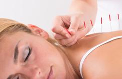Comment l’acupuncture est utilisée contre les douleurs