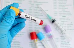 Le dépistage par PSA réduit bien la mortalité par cancer de la prostate