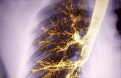 De bonnes bactéries aussi dans nos poumons?
