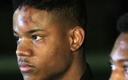 Etats-Unis: nouvelle affaire d’un jeune Noir brutalisé par des policiers blancs