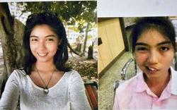 Thaïlande: une lycéenne défigurée par une tasse lancée par son professeur