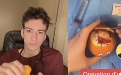 Un étudiant en médecine fait le buzz sur TikTok en opérant des fruits et légumes