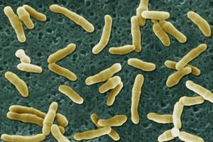 Diphtérie: cette infection bactérienne, hautement contagieuse, par voie aérienne (angine) ou cutanée a disparu de France depuis 1989.