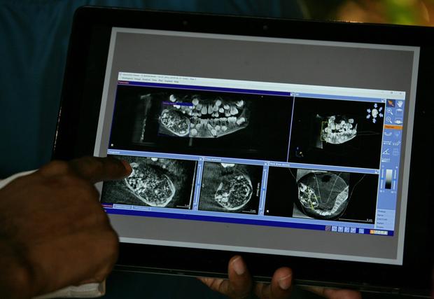 Un docteur montre les résultats de l’examen d’imagerie médicale du petit garçon.