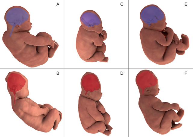Reconstruction des images en 3D obtenues par IRM avant l’accouchement (images A,C et E) et durant la seconde phase de travail (B, D, F).