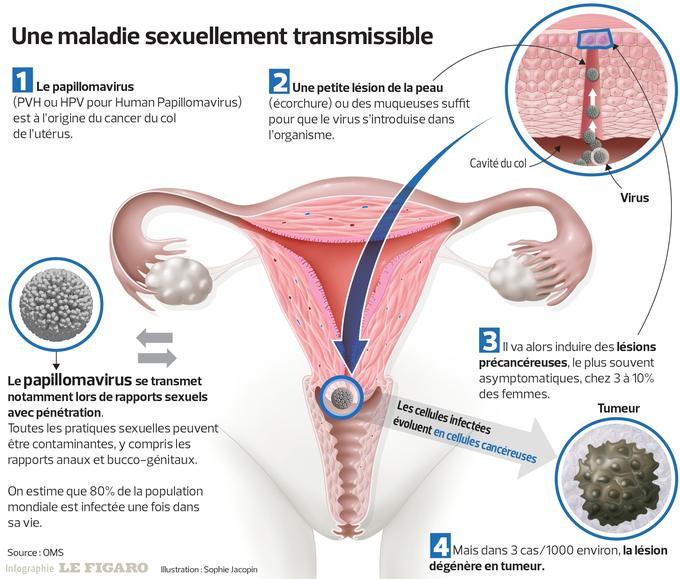 Papillomavirus femme