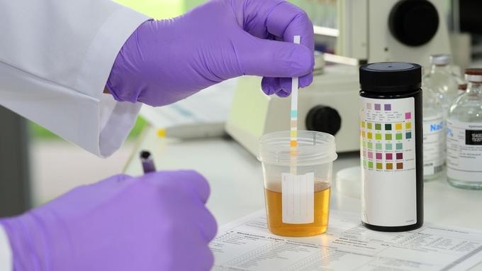 Comment se débarrasser des infections urinaires à répétition