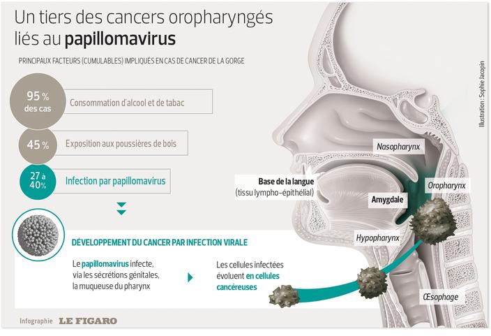 Papillomavirus sur la langue. Papillomavirus et langue